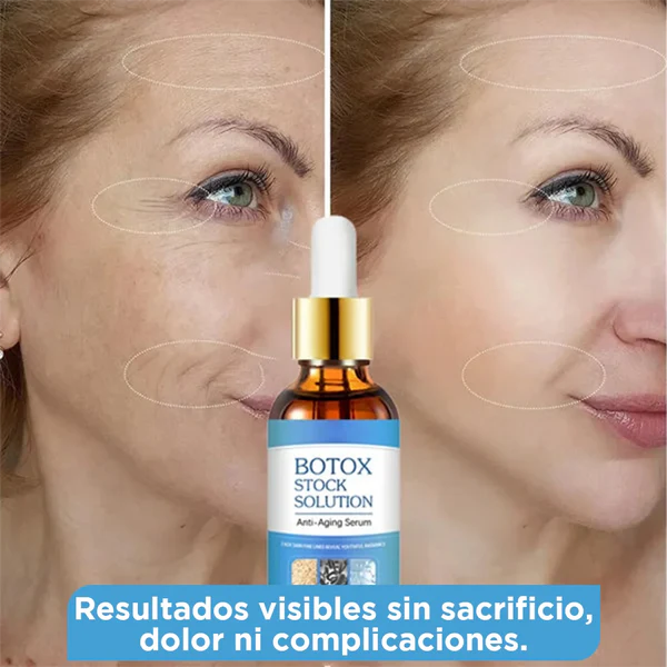 BOTOX STOCK SOLUTION